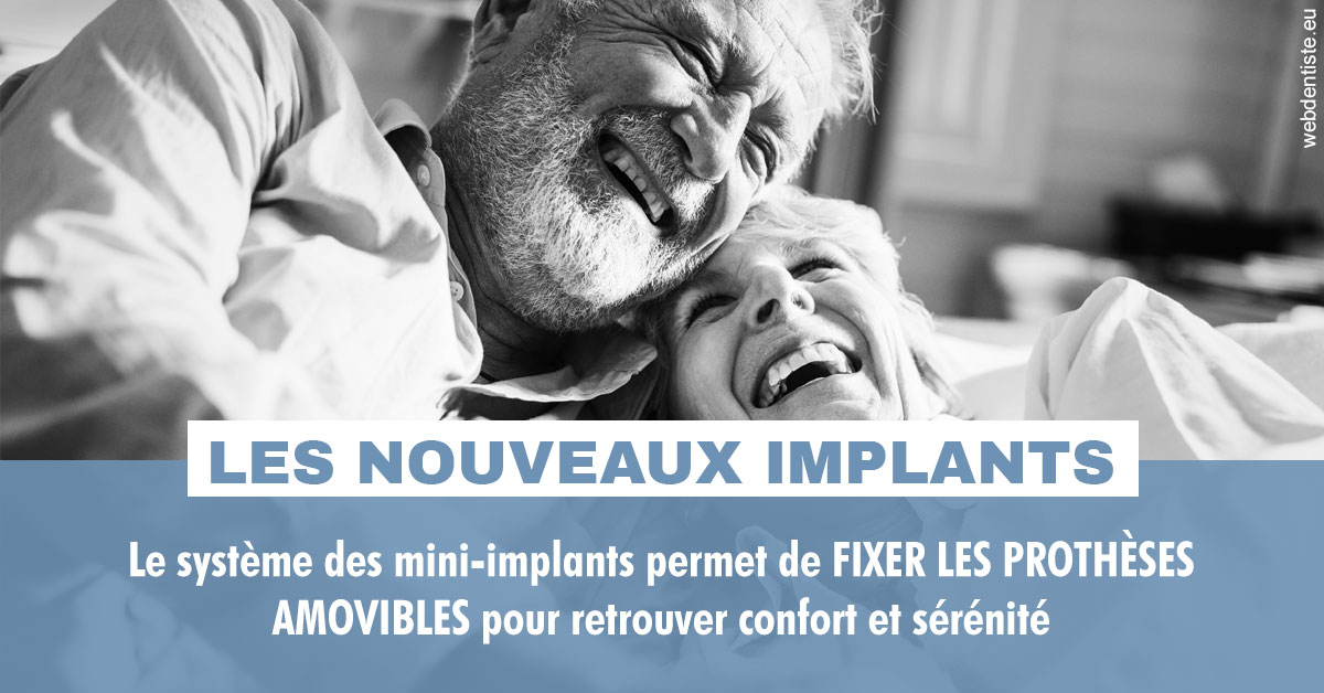 https://dr-eric-arvouet.chirurgiens-dentistes.fr/Les nouveaux implants 2