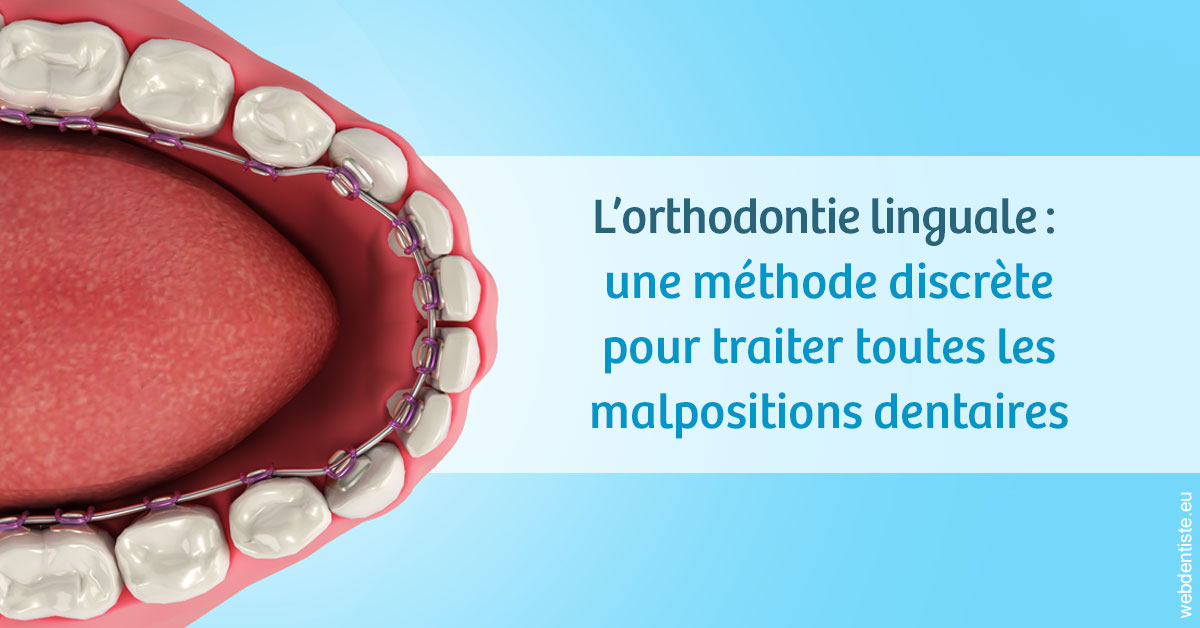 https://dr-eric-arvouet.chirurgiens-dentistes.fr/L'orthodontie linguale 1