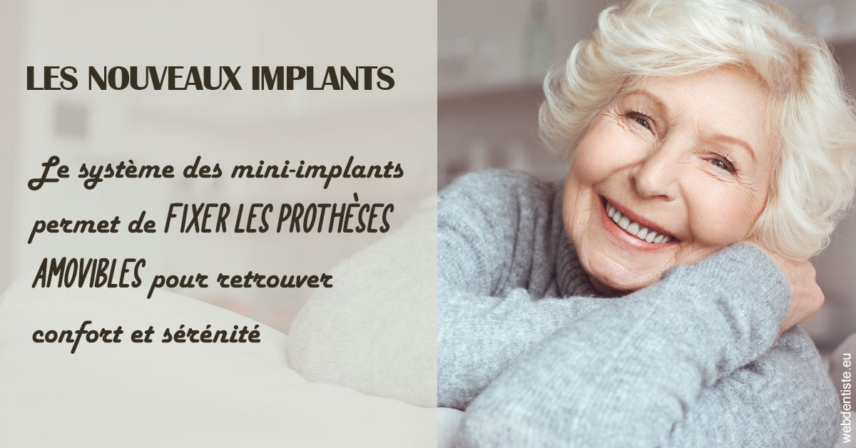 https://dr-eric-arvouet.chirurgiens-dentistes.fr/Les nouveaux implants 1