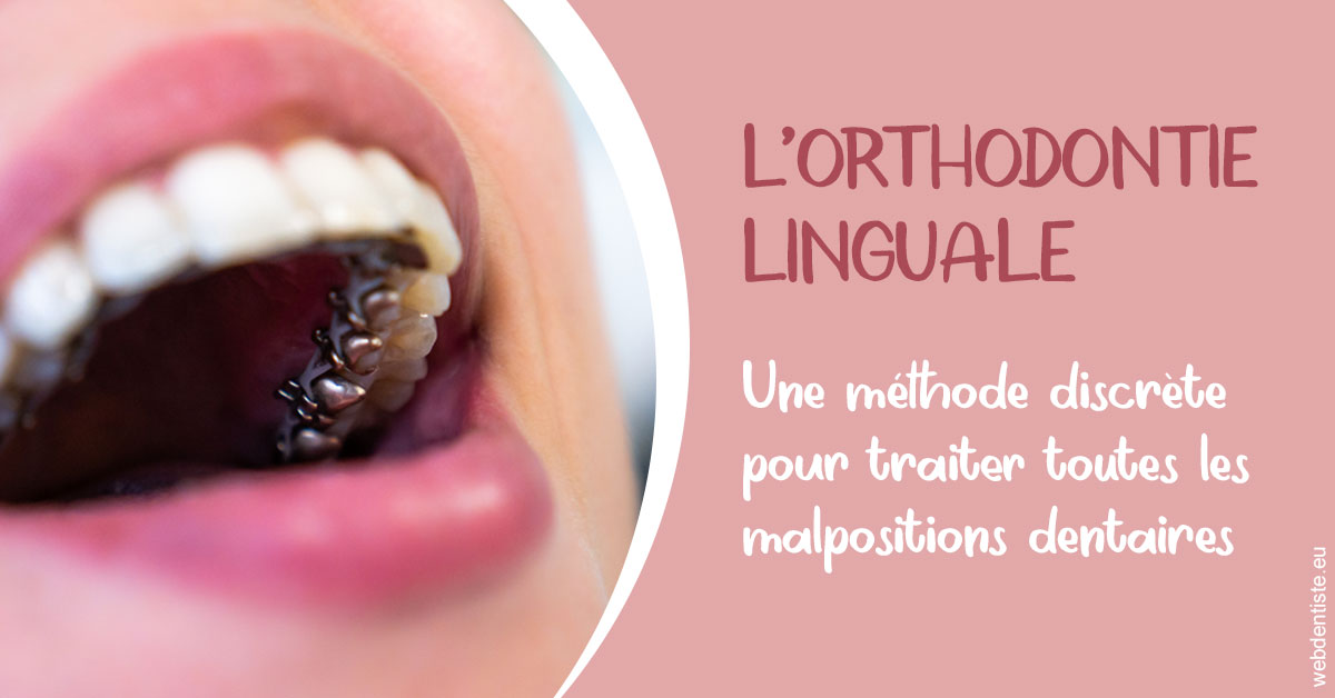 https://dr-eric-arvouet.chirurgiens-dentistes.fr/L'orthodontie linguale 2