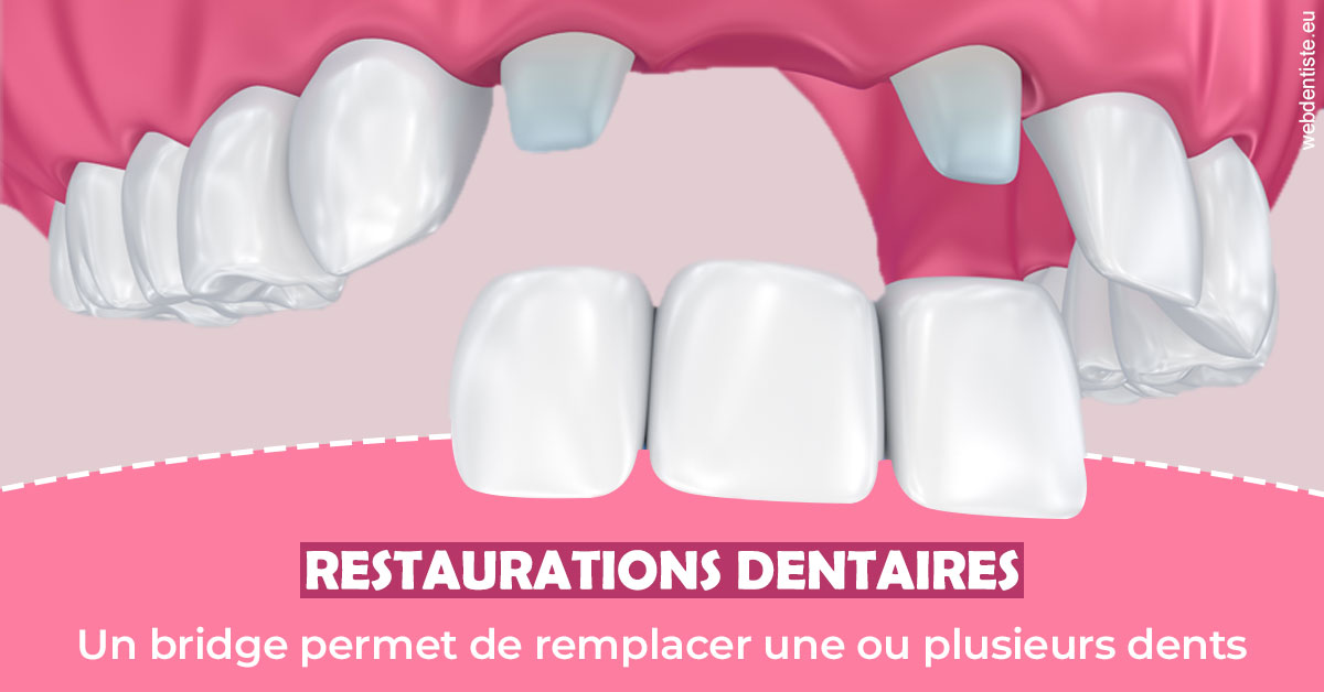 https://dr-eric-arvouet.chirurgiens-dentistes.fr/Bridge remplacer dents 2
