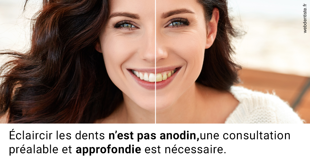 https://dr-eric-arvouet.chirurgiens-dentistes.fr/Le blanchiment 2