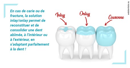 https://dr-eric-arvouet.chirurgiens-dentistes.fr/L'INLAY ou l'ONLAY