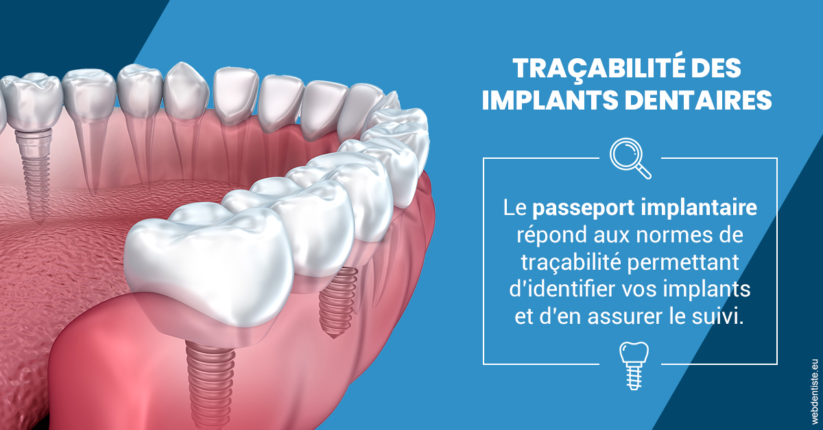 https://dr-eric-arvouet.chirurgiens-dentistes.fr/T2 2023 - Traçabilité des implants 1