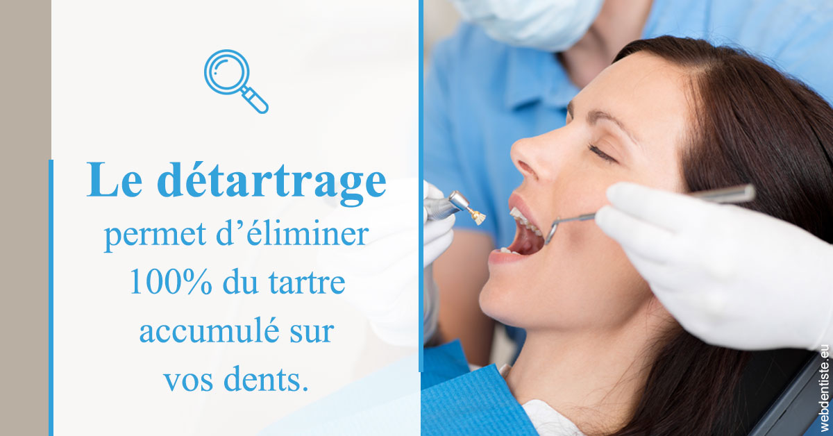 https://dr-eric-arvouet.chirurgiens-dentistes.fr/En quoi consiste le détartrage