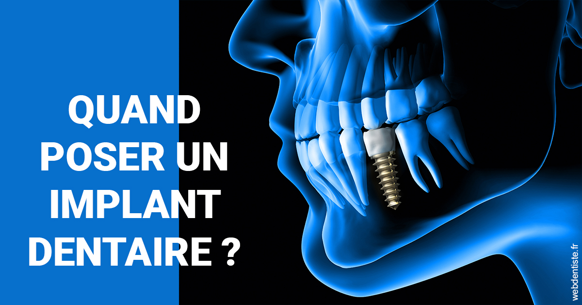 https://dr-eric-arvouet.chirurgiens-dentistes.fr/Les implants 1