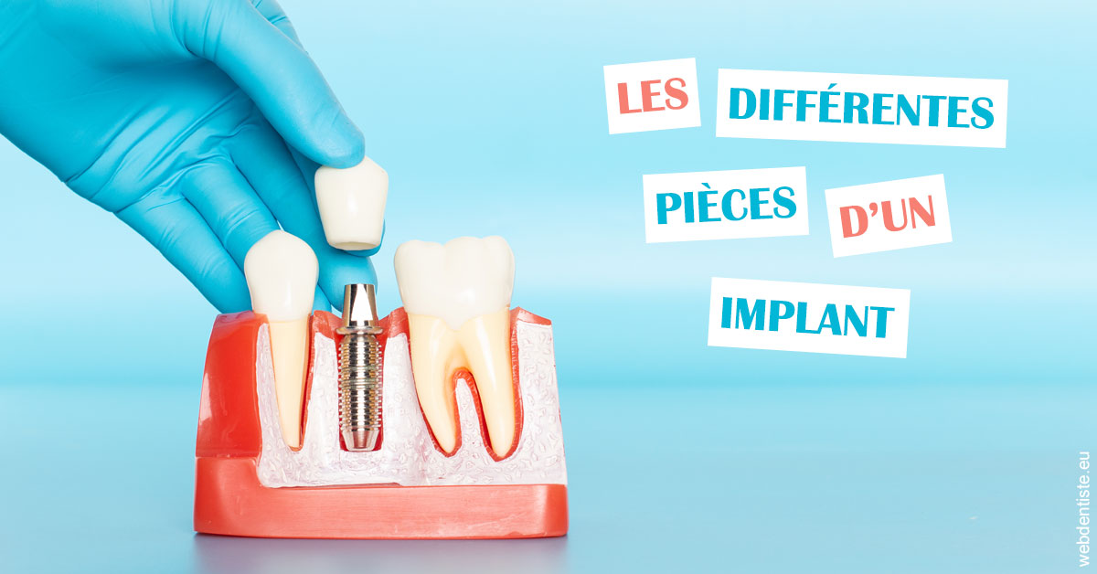 https://dr-eric-arvouet.chirurgiens-dentistes.fr/Les différentes pièces d’un implant 2