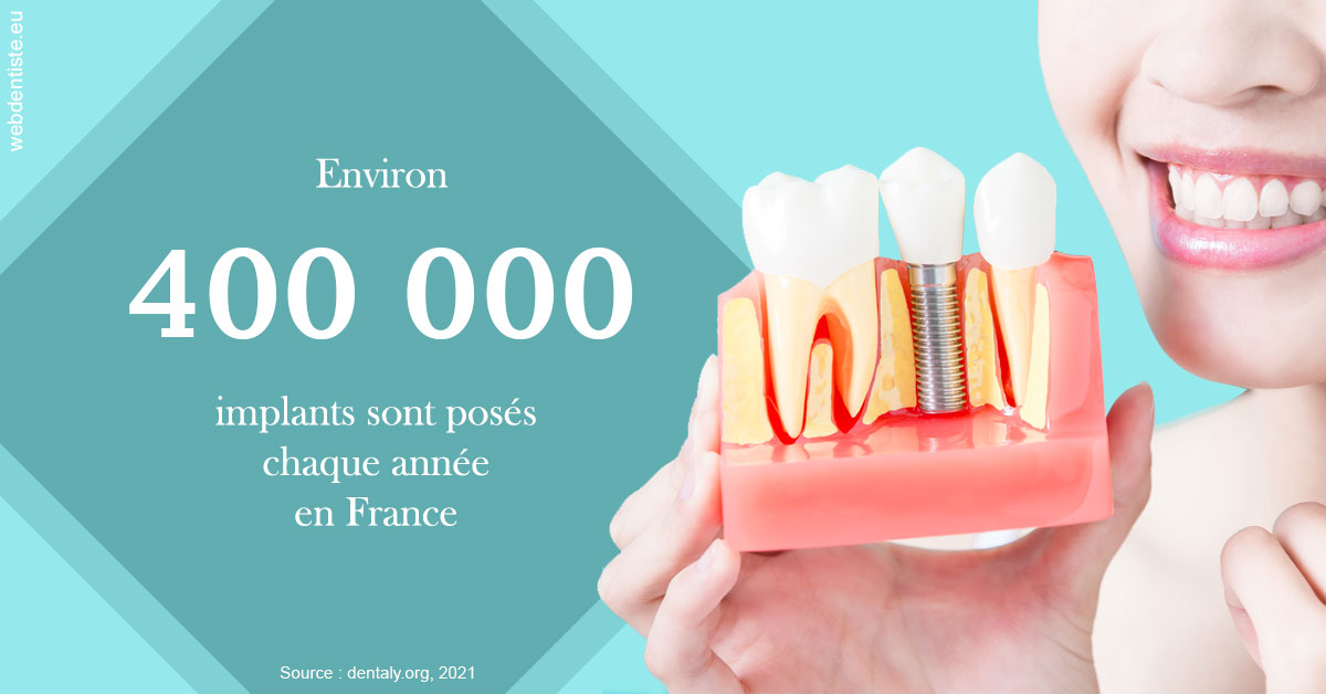 https://dr-eric-arvouet.chirurgiens-dentistes.fr/Pose d'implants en France 2